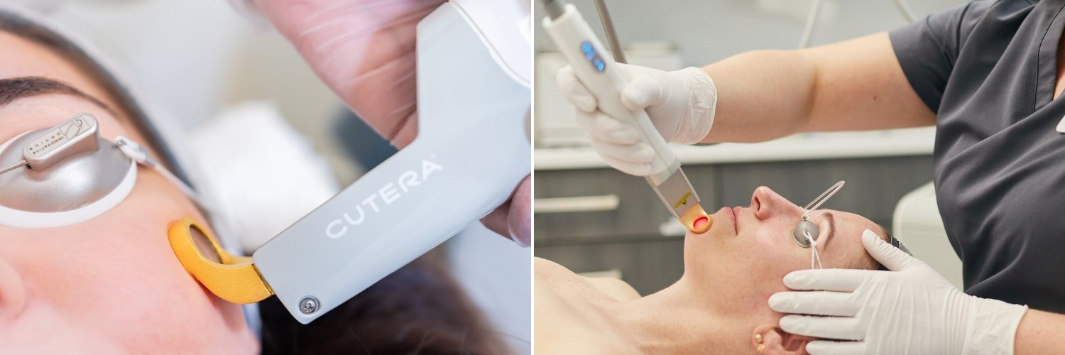 Pulse Aesthetics - laser skin treatments in Wellington